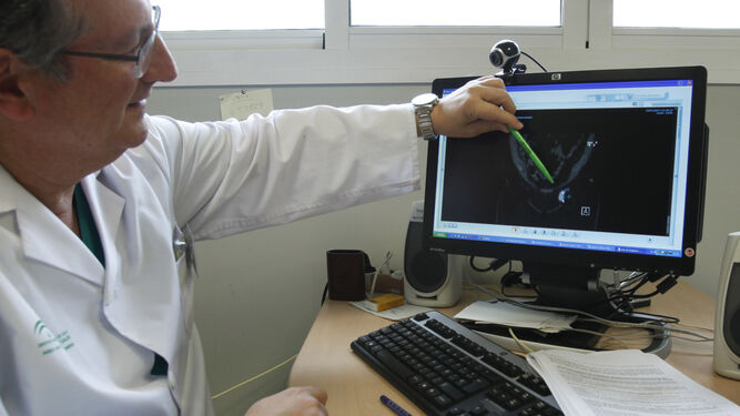 El doctor Márquez muestra una imagen con detección del ganglio centinela.