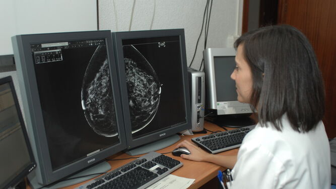 Una especialista consulta los resultados de una mamografía.