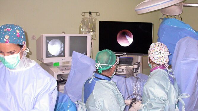 El equipo del Valme aplica la ureteroscopia flexible para eliminar cálculos renales.