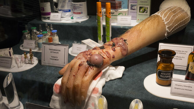 Simulación de mano afectada por veneno.