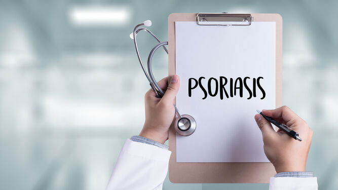 8 consejos para luchar contra la psoriasis