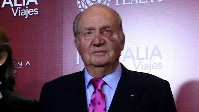 El rey Juan Carlos con el ojo morado.