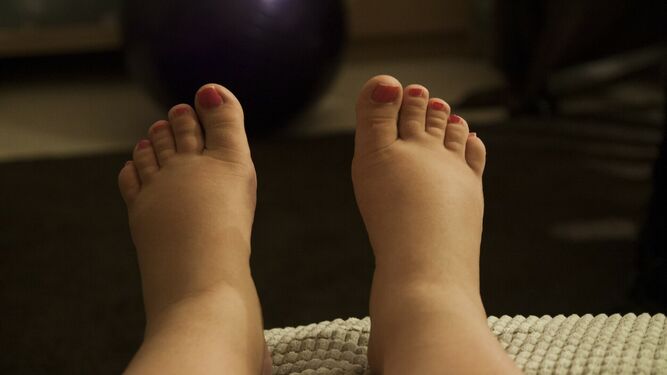 Las altas temperaturas y la falta de hidratación hacen que los pies se hinchen.