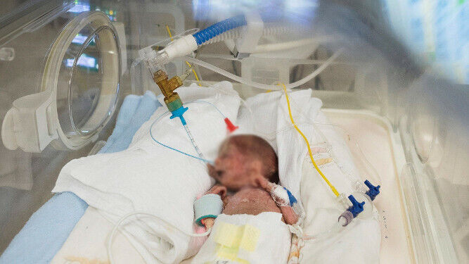 Un bebé prematuro, en una incubadora.
