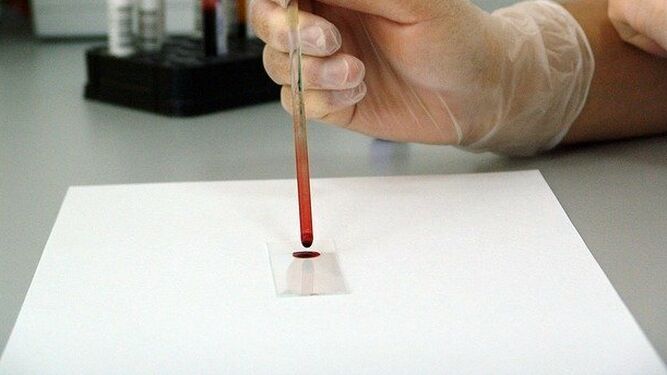 Detectar hasta trece tipos de cáncer con una gota de sangre, la nueva herramienta de Toshiba