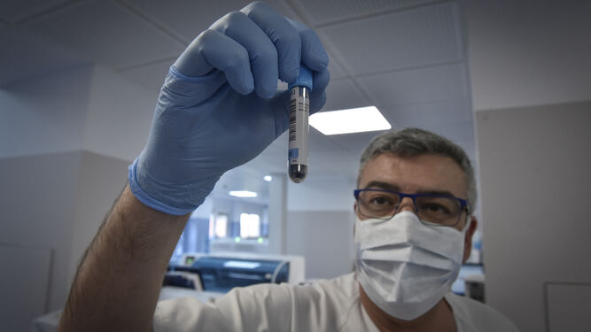 Una de las muestras de coronavirus estudiada en el laboratorio del Hospital Virgen del Rocío.