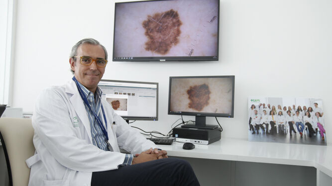 David Moreno, responsable del servicio de Dermatología  del Hospital Universitario Virgen Macarena.
