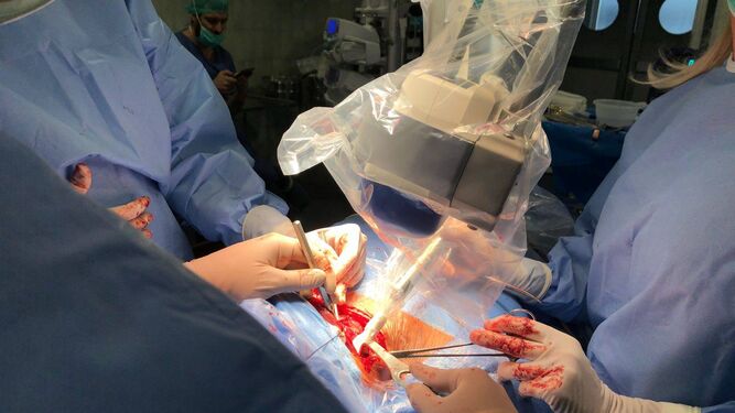 Una intervención quirúrgica por un cáncer de tiroides en el Hospital Macarena.