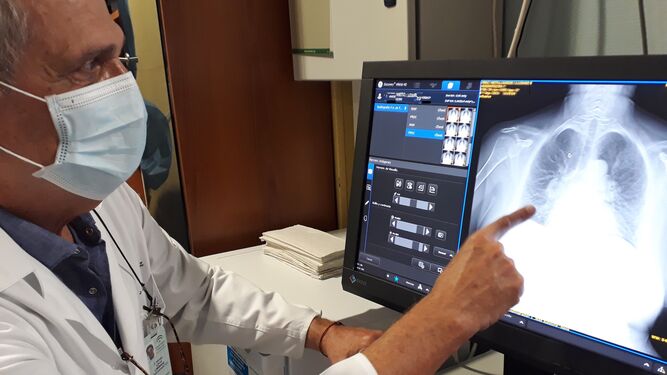El doctor Rafael Aznar, valorando una lesión pulmonar con la nueva herramienta diagnóstica incorporada.