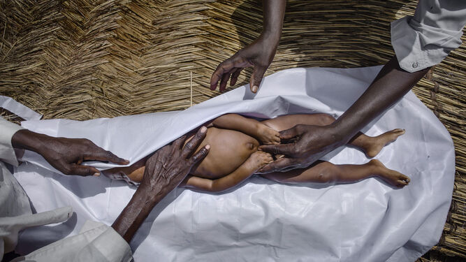 Fotografía de la exposición 'Creadores de conciencia'. 'Mortalidad infantil y pobreza. Bebedjia, República de Chad, 2013'.