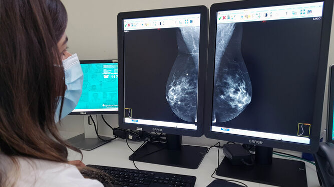 Una sanitaria observa una mamografía.