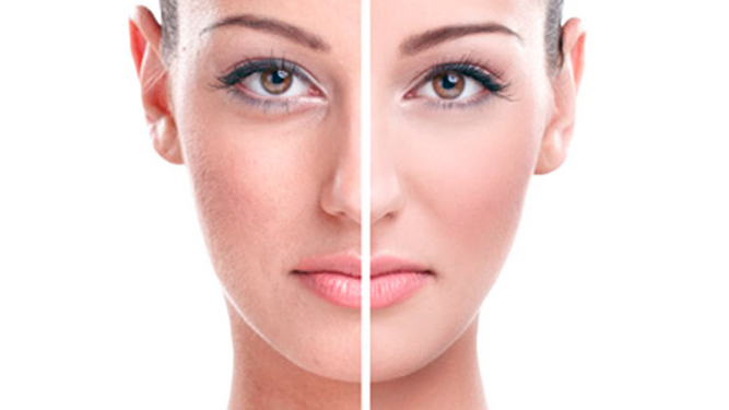 Revitalización facial, el tratamiento para una piel más luminosa.