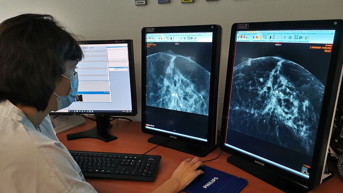 La radióloga, Cristina Gómez de las Heras, estudiando una mamografía realizada con la técnica de Tomosíntesis.
