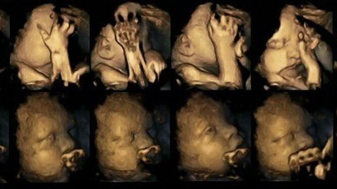 Imágenes en 4D muestran la reacción de un feto en el vientre materno al tabaco