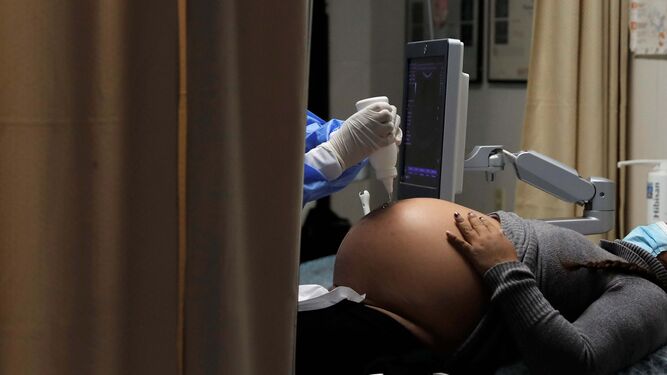Una mujer embarazada durante una ecografía.