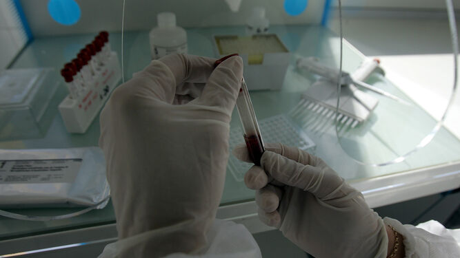Una muestra de sangre en un laboratorio.