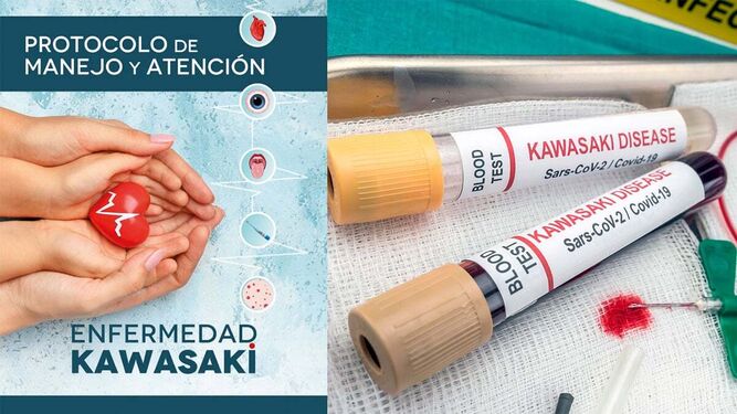 Se publica el primer informe sobre la enfermedad de Kawasaki