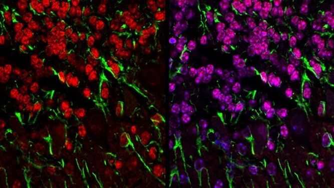 Corte histológico de cerebelo de ratón modelo de enfermedad mitocondrial con neuronas granulares marcadas en rojo y prolongaciones gliales en verde.