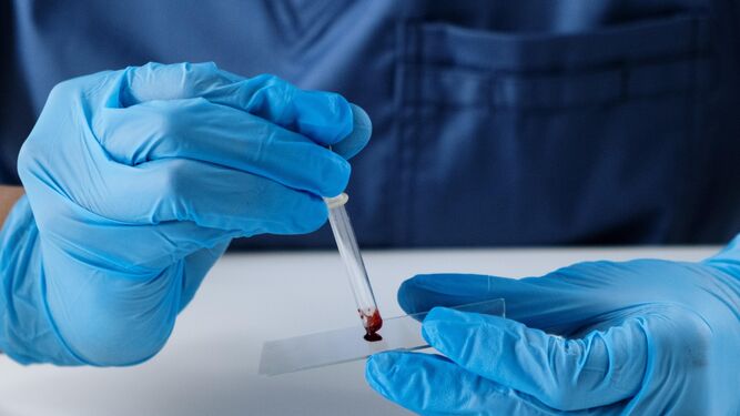 El nuevo análisis de sangre que detecta casos de pacientes de cáncer con síntomas inespecíficos