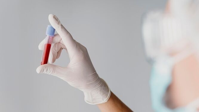 Muestra de sangre en un laboratorio