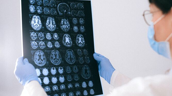 Un grupo de científicos detecta actividad cognitiva en el cerebro de un paciente segundos antes de morir.