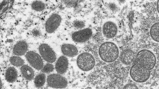 ¿Puede mutar el virus de la 'viruela del mono' y volverse más contagioso?  Hablan los expertos