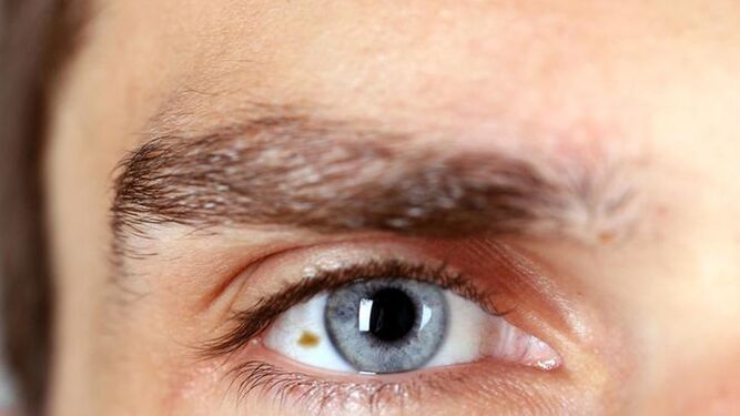 Síntomas y signos del melanoma ocular, un potencial cáncer metastásico