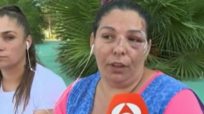 Josefa, mujer atropellada por su yerno en Valencia