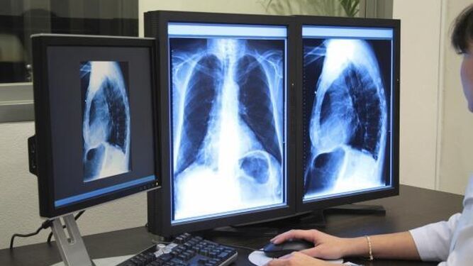 Un profesional examina una radiografía