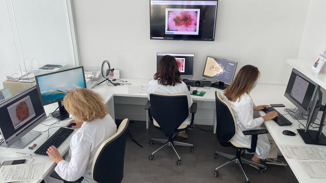 Muchos melanomas se detectan a través de las consultas por teledermatología