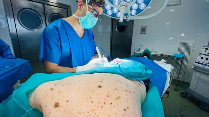 Intervención quirúrgica de melanoma a un paciente de edad avanzada en el Macarena.